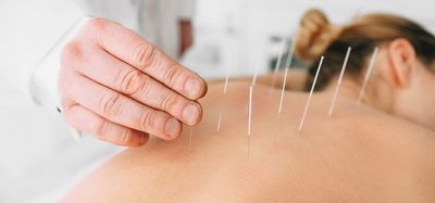 Link to: https://www.fcmt.ca/services/acupuncture